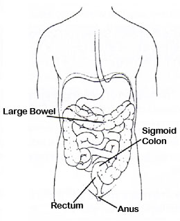 Paul Sylvester :: Sigmoidoscopy